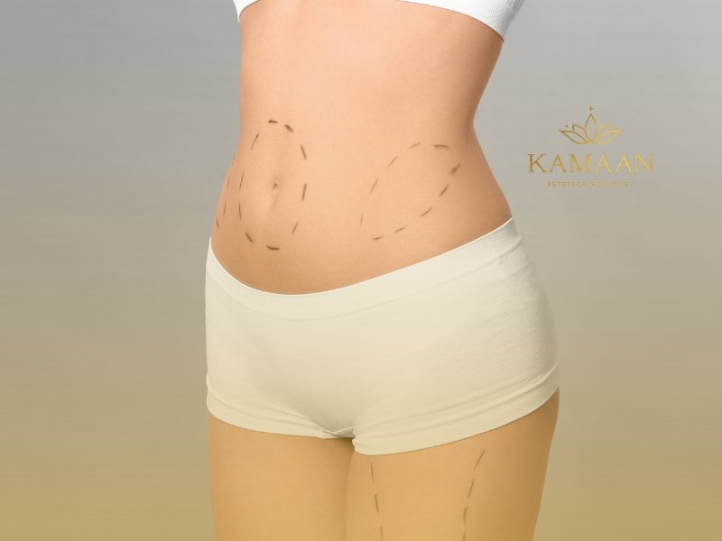 Kamaan Estética e Saúde - Clínica de Estética Corporal